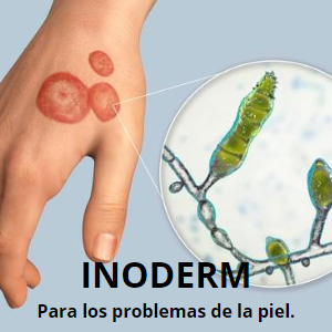 Inoderm Ointment 2 Pack - Effective Treatment for Skin Conditions, 2x45g