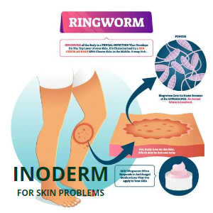 Inoderm Ointment 2 Pack - Effective Treatment for Skin Conditions, 2x45g