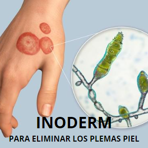 Pack Crema Inoderm + 2 Jabones Inoderm | Tratamiento Completo para una Piel Sana y Libre de Imperfecciones